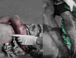 Ngeri! Petani di Muna Barat Nyaris Tewas usai di Terkam Buaya, Kaki Dan Tangan Luka