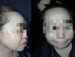 Dipicu Cemburu, Istri Siri Oknum Polisi Diduga Aniaya Pacar Suami