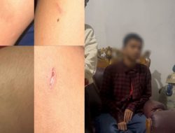 Seorang Gadis Remaja di Kendari Dianiaya Pakai Gunting, Anak Polisi Dilaporkan ke Polisi